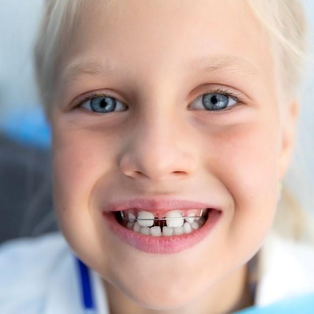 زیبایی دندان ها در کودکان